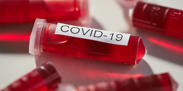 COVID-19 Virus Strains and Variants: What to do to Avoid or Support Treatment
